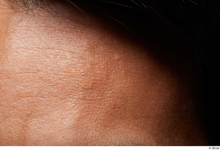 HD Face Skin Moises Molina forehead hair skin pores skin…